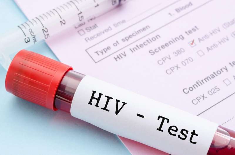 Anonymous HIV Testing Services in Miami