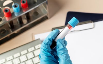 Free HIV Testing in Miami-Dade What Can Affect HIV Test Results?