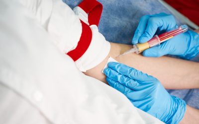 Free HIV Testing in Miami-Dade Is HIV an Autoimmune Disease?